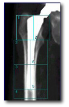 DEXA Photo-1