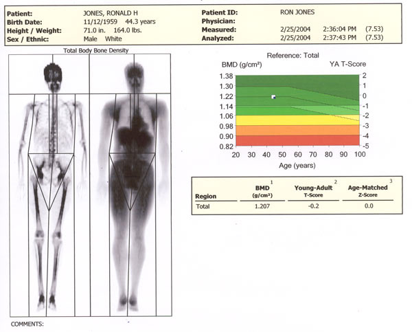 Body Fat Scan 55